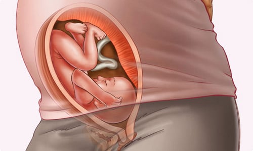 Những thay đổi của thai nhi tuần 29