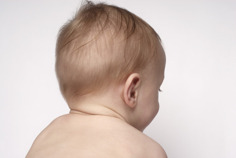  Trẻ sơ sinh bị rụng tóc vành khăn có đáng lo không?