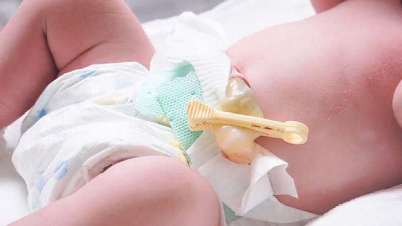 vệ sinh rốn cho trẻ sơ sinh