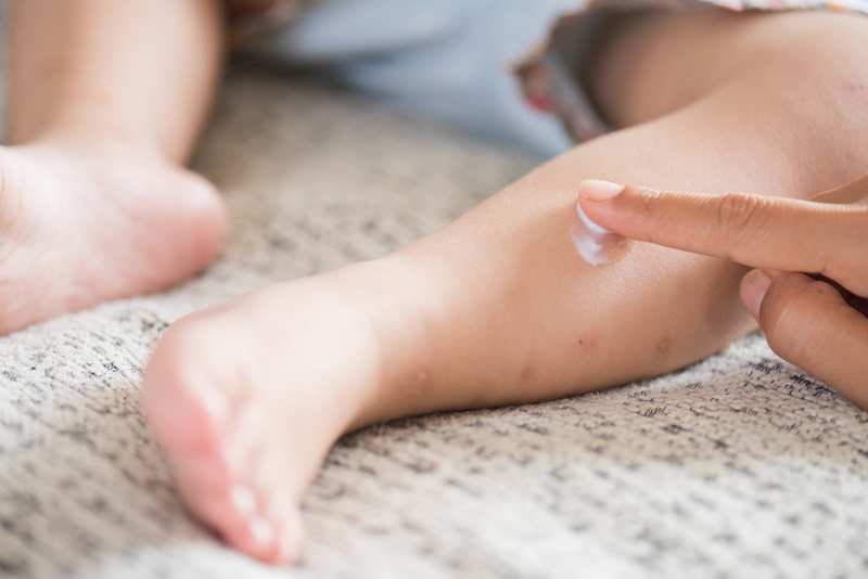 Những lưu ý khi chăm trẻ nhỏ bị thủy đậu