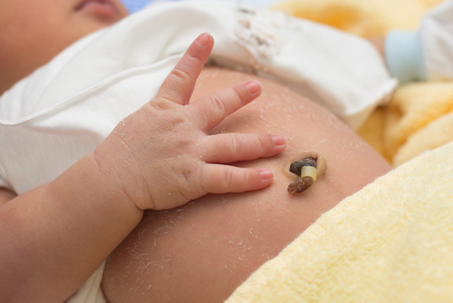 Chăm sóc rốn trẻ sơ sinh – Nnhững dấu hiệu bất thường không nên bỏ qua