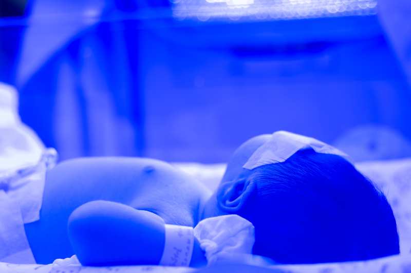 Điều trị bé bị vàng da sơ sinh bằng phương pháp chiếu đèn ánh sáng màu xanh