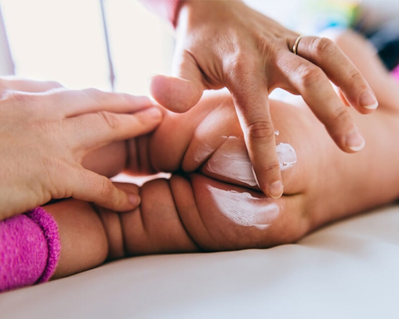 Be bi ham ta phai lam sao - Cách chữa hăm cho bé bằng thuốc có thành phần lành tính  