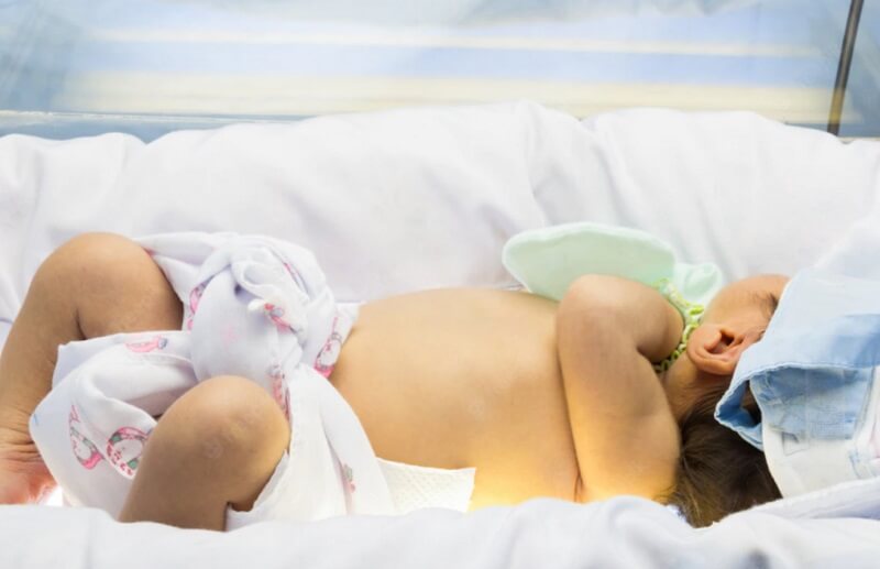 Cách tắm nắng cho trẻ sơ sinh bị vàng da an toàn