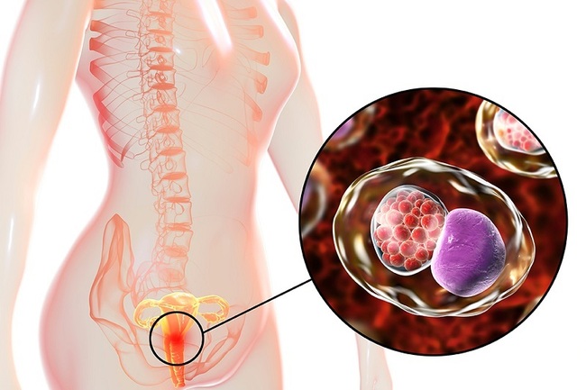  Viêm nhiễm nấm Chlamydia thường ra nhiều khí hư màu vàng và chảy máu âm đạo