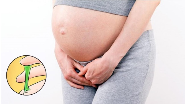Mang thai cũng có thể gây xuất khí hư màu xanh