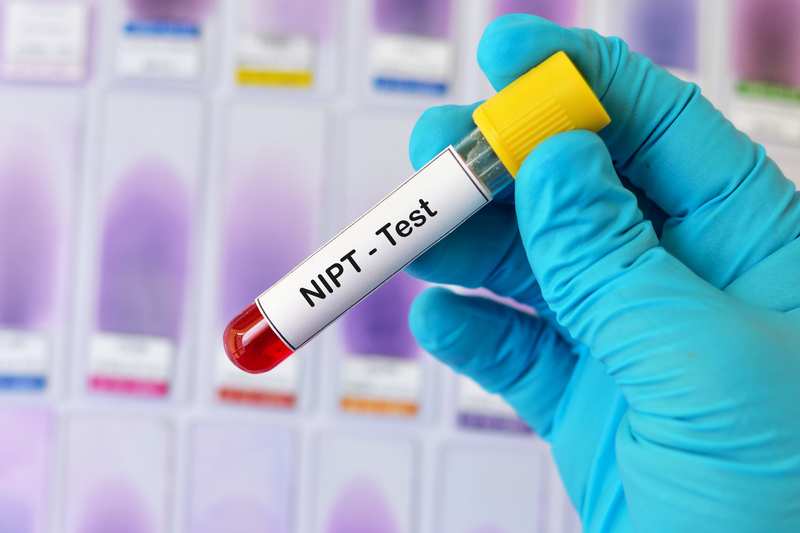 Kết quả đo độ mờ da gáy và phương pháp kết hợp NIPT