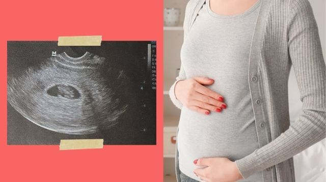 Hình ảnh thai nhi 8 tuần tuổi