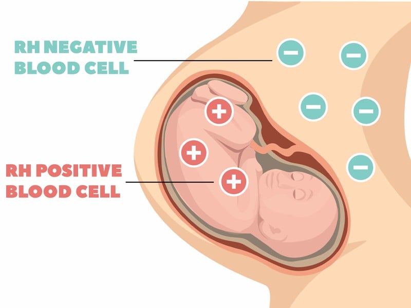 Xét nghiệm máu Rh dương tính có sao không