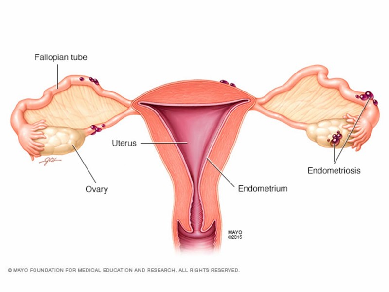  Độ dày niêm mạc tử cung ảnh hưởng đến việc mang thai