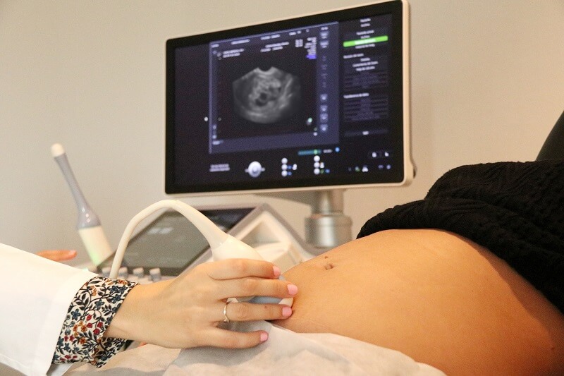  Siêu âm và xét nghiệm là 2 cách chẩn đoán thai trứng nhanh nhất