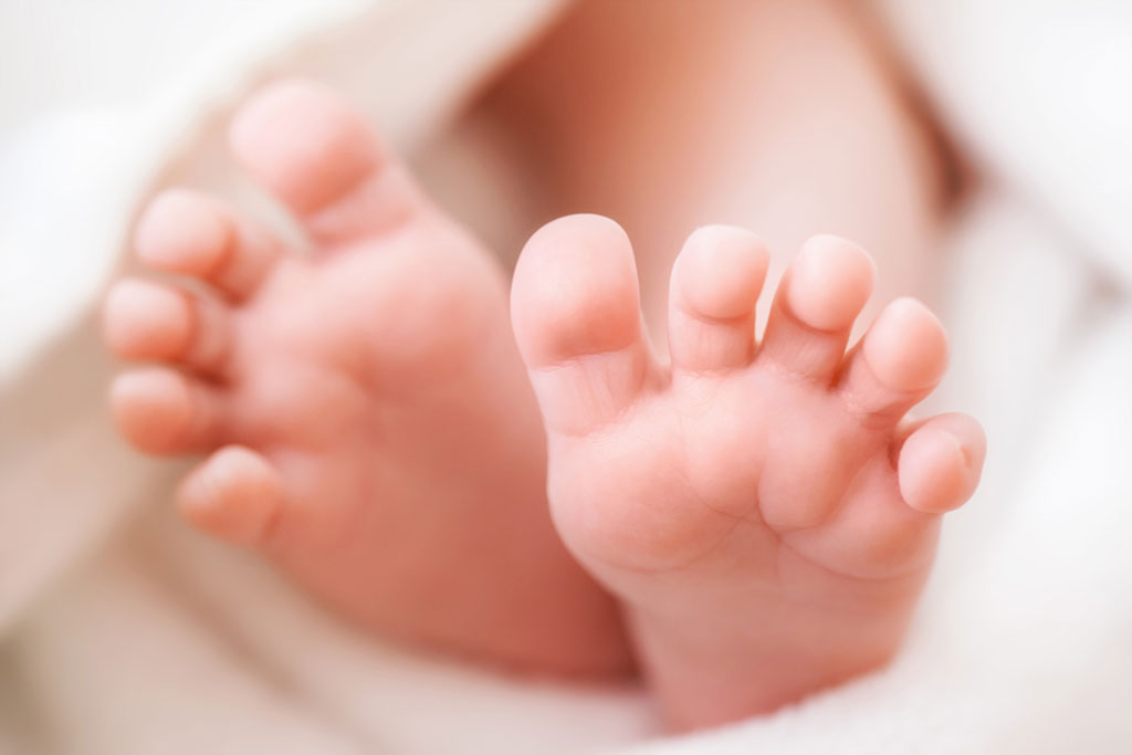 Tử Vong Chu Sinh: Nguyên Nhân, Yếu Tố Nguy Cơ và Biện Pháp Phòng Ngừa