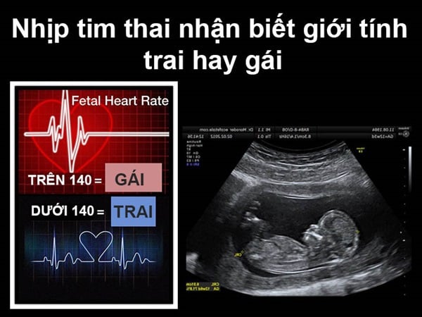 Nhịp tim thai dưới 140 lần/ phút là con trai. Trên 140 lần/phút là con gái