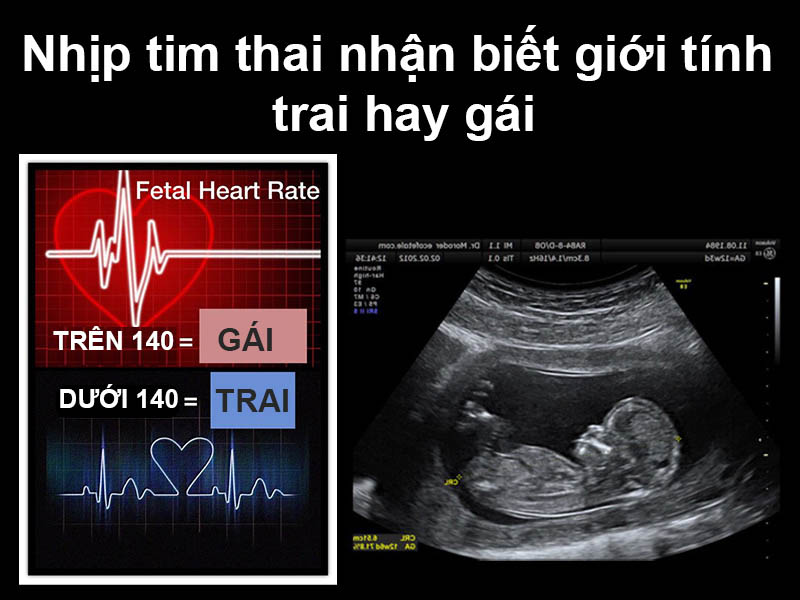 Nhịp tim thai dưới 140 lần/ phút là con trai. Trên 140 lần/phút là con gái