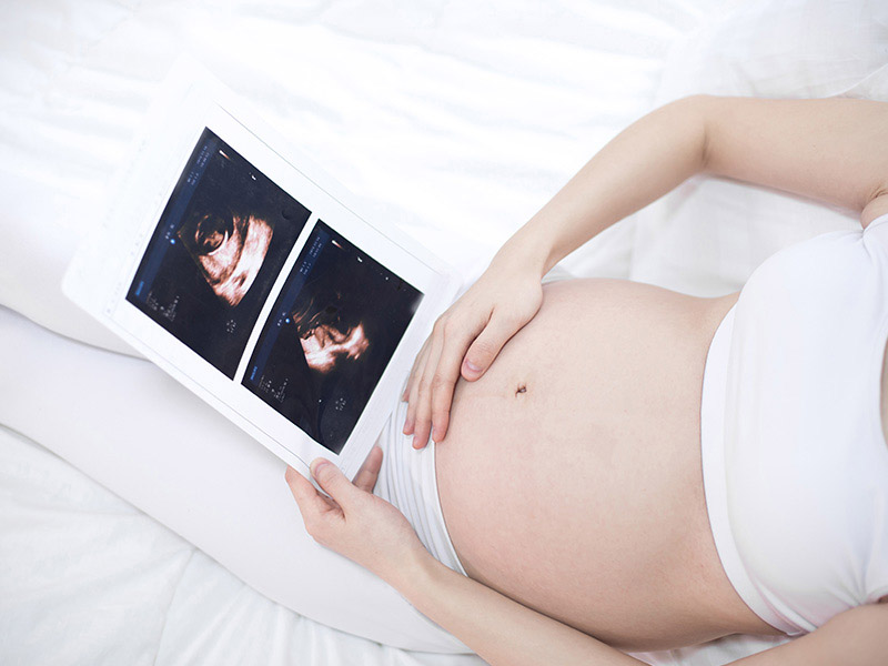 Siêu âm thai 4 tháng để biết giới tính thai nhi trai hay gái chính xác, sớm nhất