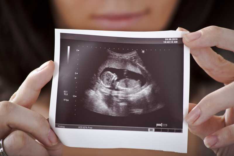 Siêu âm thai 12 tuần: Lịch khám thai quan trọng - Huggies