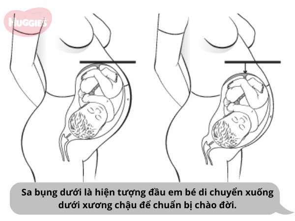 Sa bụng dưới là dấu hiệu sắp sinh vào giai đoạn cuối thai kỳ