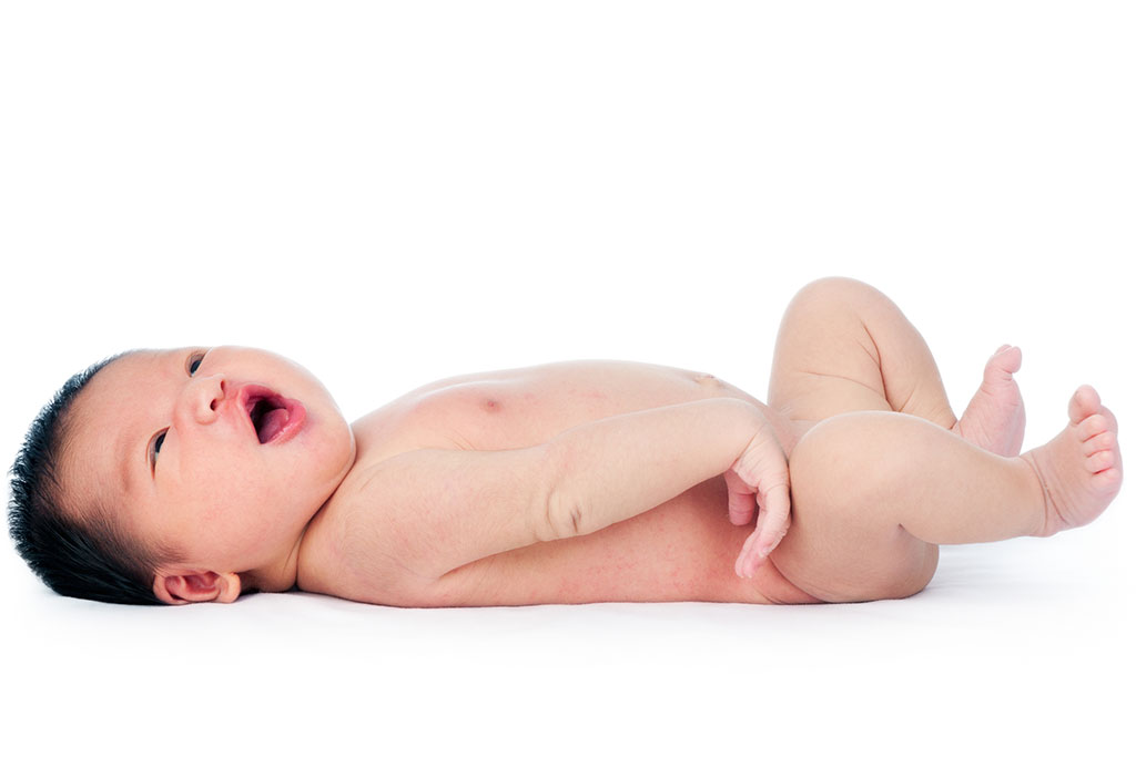 Can thiệp giục sinh bằng phương pháp lóc ối | Huggies Can thiệp giục sinh bằng phương pháp lóc ối | Huggies