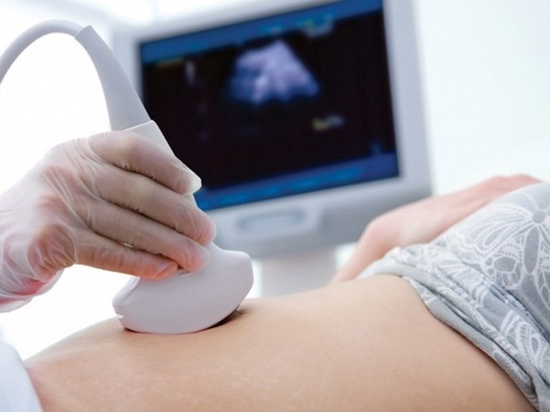Tính tuần thai bằng phương pháp siêu âm