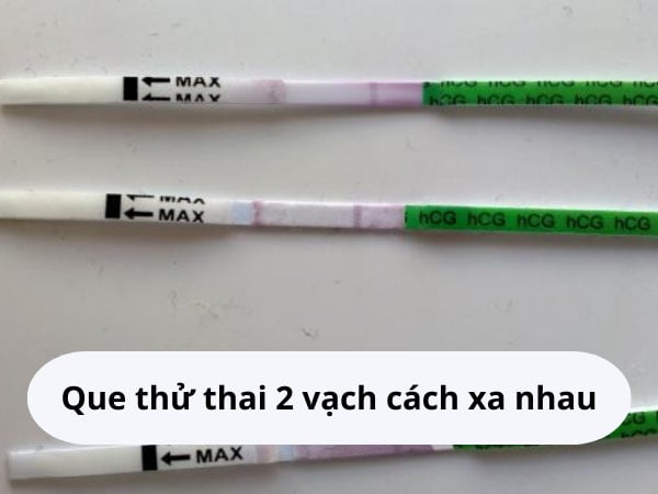 Hình Ảnh Que Thử Thai 2 Vạch Đậm, Mờ, Cách Xa Nhau Tự Chụp | Huggies