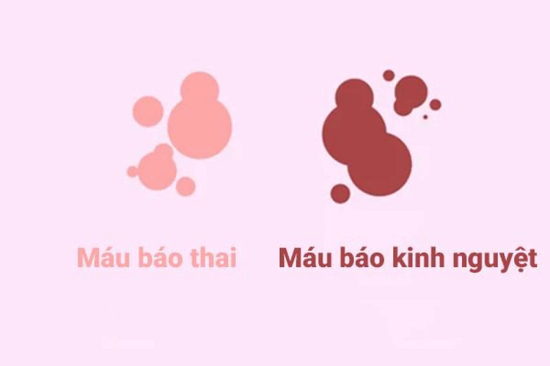 Phân biệt máu báo thai và máu báo kinh nguyệt