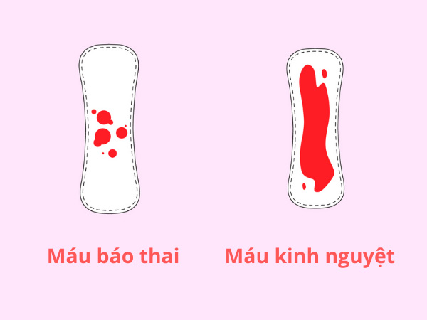 Máu báo thai thường có màu nhạt hơn so với máu kinh nguyệt