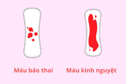  Nhận biết mang thai bằng dấu hiệu máu báo thai