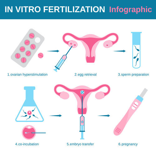 quy trình thụ tinh trong ống nghiệm IVF