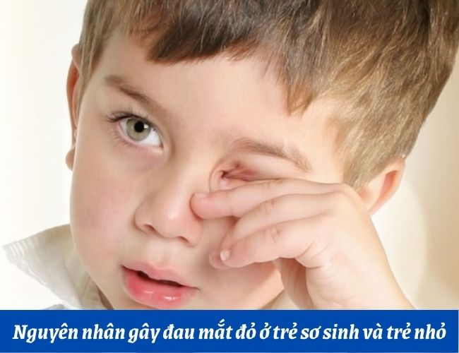 Nguyên nhân gây đau mắt ở trẻ sơ sinh và trẻ nhỏ?