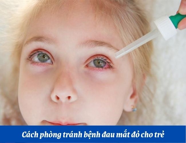 Cách phòng tránh bệnh đau mắt đỏ cho trẻ