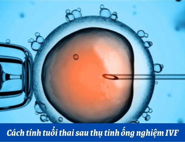 4. Cách tính ngày mang thai sau khi thụ tinh ống nghiệm IVF
