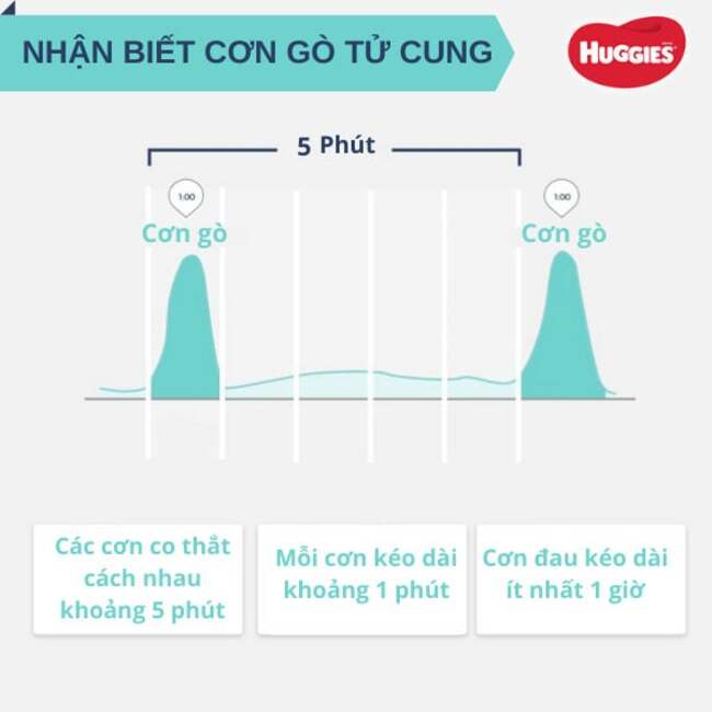 Cách tính thời gian cho các cơn co thắt chuyển dạ