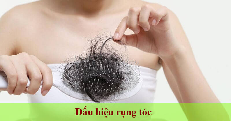 Rụng tóc nhiều hơn là một trong những biểu hiện của có thai thường gặp