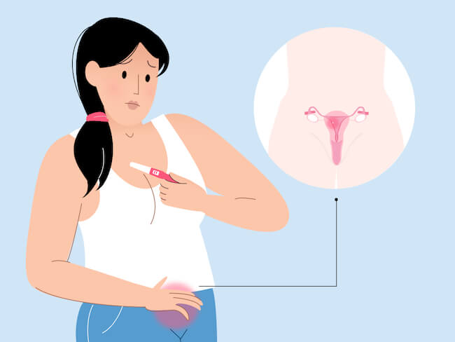 Đau bụng dưới khi mang thai xảy ra do quá trình thai nhi làm tổ ở tử cung
