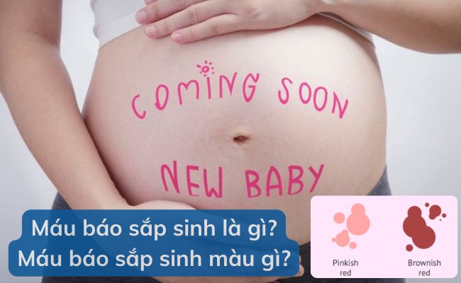 Máu báo sắp sinh có màu gì?