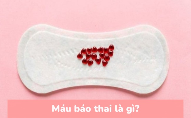 Máu báo thai là gì?