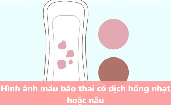 Hình ảnh máu báo thai có dịch hồng nhạt hoặc nâu