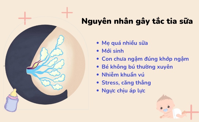 nguyên nhân gây nghẽn tia sữa là gì