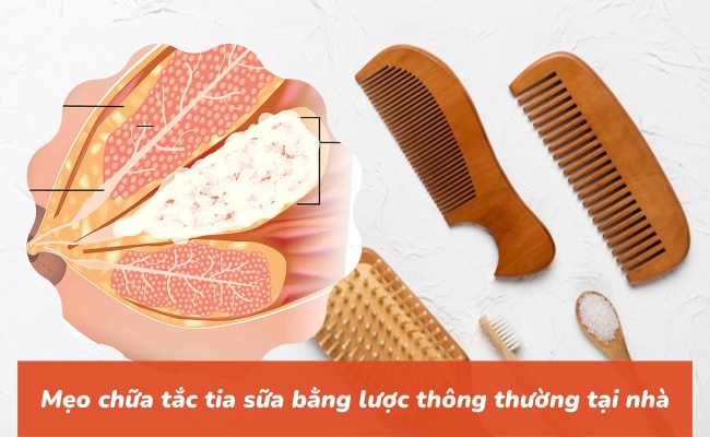 mẹo chữa tắc tia sữa bằng lược