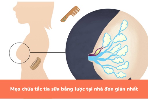 Chữa trị tắc tia sữa bằng cao dán thảo dược như thế nào?