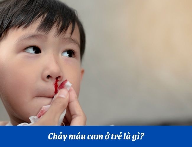 Chảy máu cam ở trẻ nhìn đáng sợ nhưng hầu hết không có gì đáng lo ngại