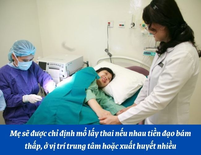 Khi mẹ bị rau tiền đạo, nguyên tắc chung khi điều trị là phải thực hiện cầm máu cho thai phụ