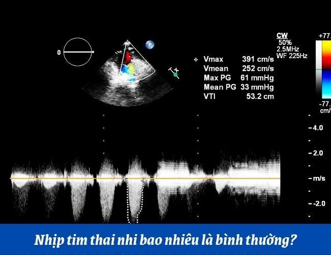 Nhịp tim thai nhi bao nhiêu là bình thường