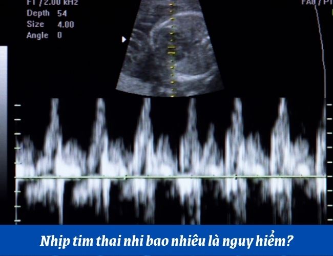 Nhịp tim thai nhi bao nhiêu là nguy hiểm?