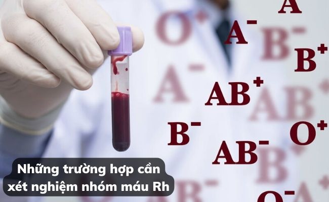 Những trường hợp cần xét nghiệm nhóm máu Rh