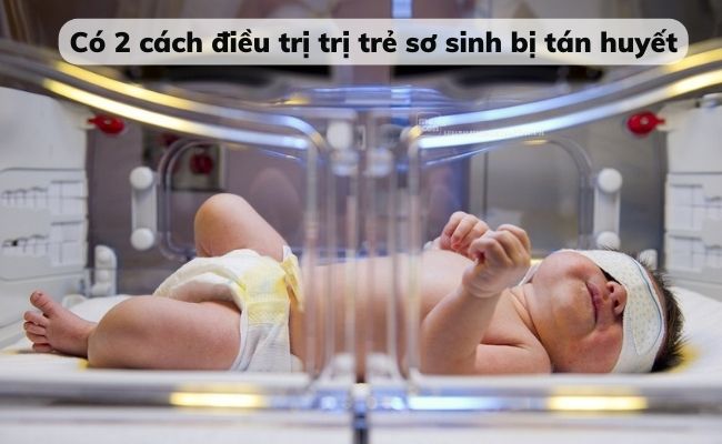 Trẻ sơ sinh bị tán huyết thường có biểu hiện vàng da, thiếu máu