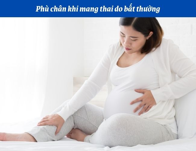 Rất nhiều mẹ bầu bị phù chân khi mang thai, nhất là trong tam cá nguyệt thứ 3