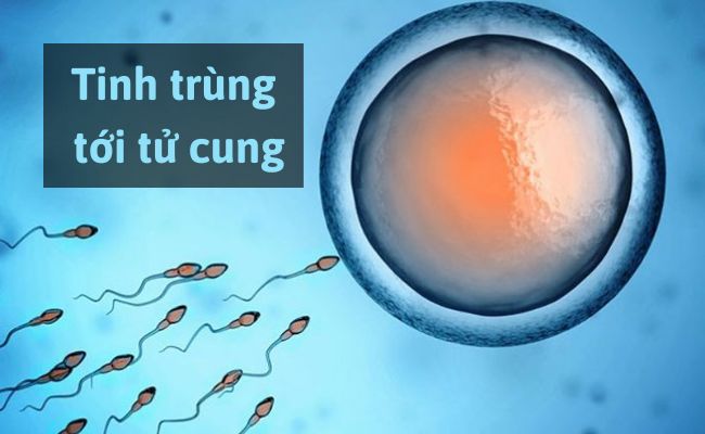 Tinh trùng tiến tới tử cung để gặp trứng sau khi được phóng vào âm đạo nhờ tinh dịch