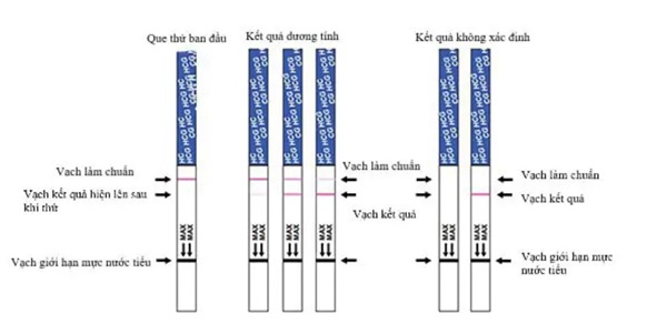 Que thử thai giúp xác định nồng độ hCG - loại hormone chỉ tiết ra khi phụ nữ mang thai