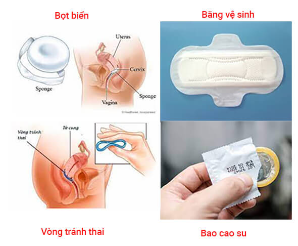 Ra khí hư màu nâu do vật lạ vào trong âm đạo